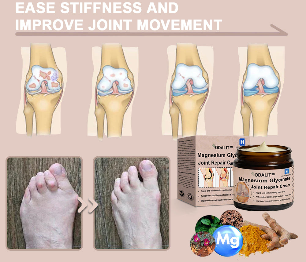 ✨ ODALIT™ Magnesium Glycinate Joint Repair Cream (Effective relief for arthritis, nerve pain, rheumatic conditions, sports injuries, and muscle spasms)✨