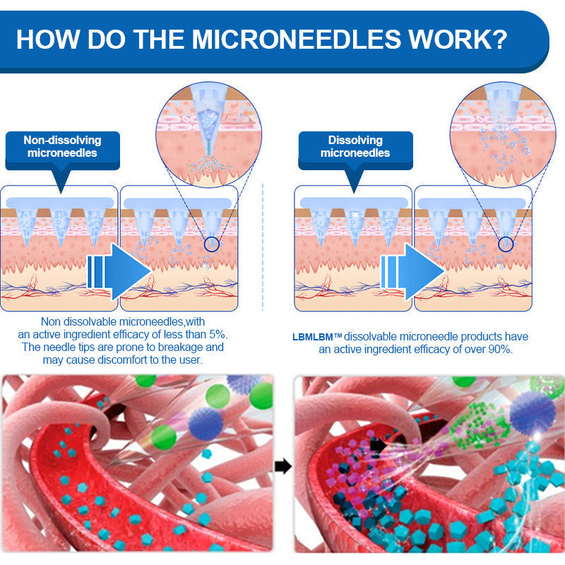 🥇【Last Day Promotion 60% OFF】🌟LBMLBM™ SMGT-GLP-1 NIDDK-Tirzepatide NANO MICRONEEDLE PATCH🇺🇸👨⚕️Zero Pain, 24/7 Release | Lose 20lbs FAST | 90% Sugar Drop |
