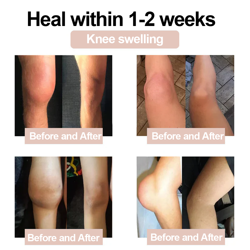 ✨ ODALIT™ Magnesium Glycinate Joint Repair Cream (Effective relief for arthritis, nerve pain, rheumatic conditions, sports injuries, and muscle spasms)✨
