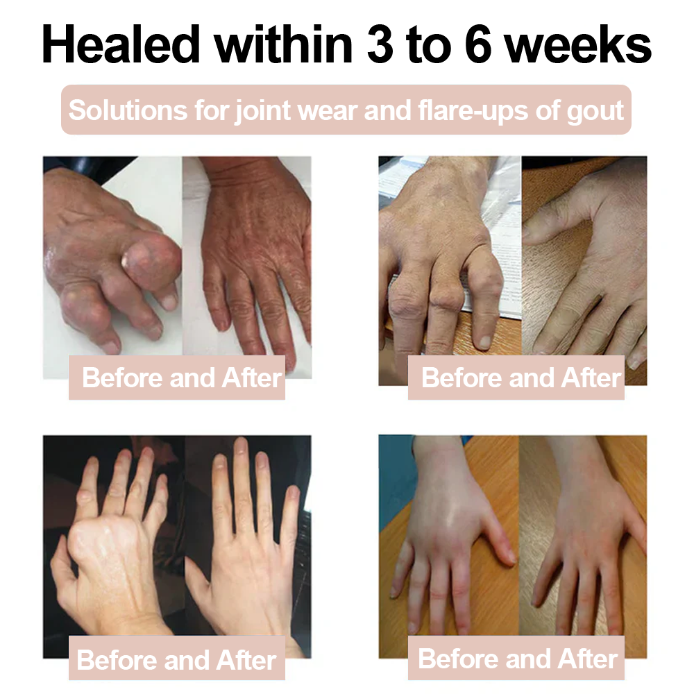 ✨ ODALIT™ Magnesium Glycinate Joint Repair Cream (Effective relief for arthritis, nerve pain, rheumatic conditions, sports injuries, and muscle spasms)✨