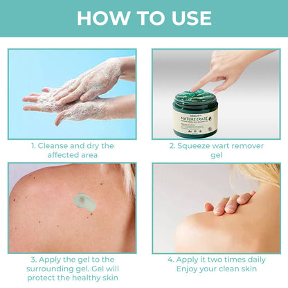 🥇Official Store: ODALIT™ Nature Erase Instant Mole & Spot Removal Gel | 🌿 Alligator Oil + Seaweed Extract🔥