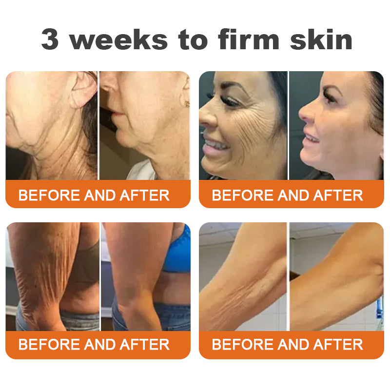 🥇ODALIT™🐝 Botox Bee Venom Firming Serum Stick | Reduces Wrinkles, Firms Skin, 30 Days Results, 50% OFF for Limited Time!💖