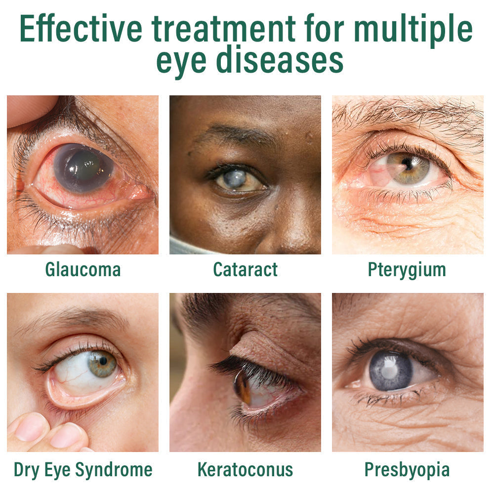 🥇ODALIT™ Nano Eye Drops Serum ✅FDA Approved(Suitable for presbyopia, dry eye syndrome, glaucoma, and cataracts)