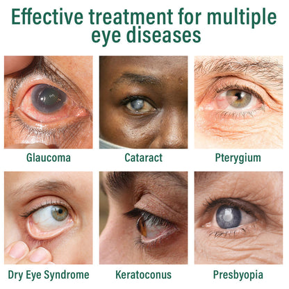 🥇ODALIT™ Nano Eye Drops Serum ✅FDA Approved(Suitable for presbyopia, dry eye syndrome, glaucoma, and cataracts)