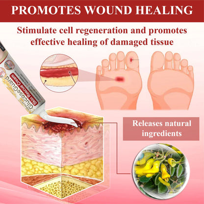 ODALIT™ GlucoseGuard Skin Rescue Cream – Hydrating & Healing Care for Diabetic Skin | 50% OFF Today