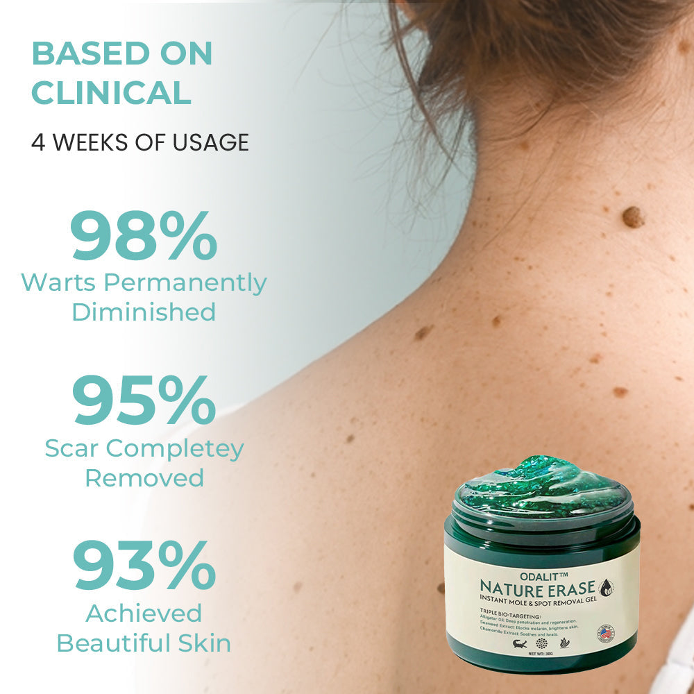 🥇Official Store: ODALIT™ Nature Erase Instant Mole & Spot Removal Gel | 🌿 Alligator Oil + Seaweed Extract🔥