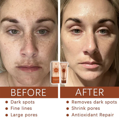 🔥LBMLBM™ Herbal Spots Peel-Off Facial Mask | Blackhead & Blemish Removal, Anti-Aging & Pore Tightening|🔥Limited Time 50% OFF!