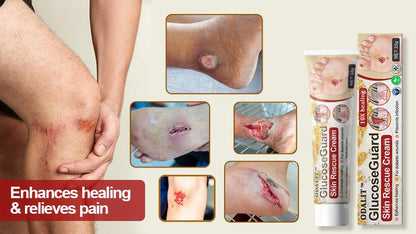 ODALIT™ GlucoseGuard Skin Rescue Cream – Hydrating & Healing Care for Diabetic Skin | 50% OFF Today