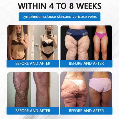 ✅ Best Seller-LBMLBM® SMGT-GLP-1 𝐓𝐢𝐫𝐳𝐞𝐩𝐚𝐭𝐢𝐝𝐞 & 𝐂𝐨𝐥𝐥𝐚𝐠𝐞𝐧 𝐍𝐚𝐧𝐨 𝐌𝐢𝐜𝐫𝐨𝐧𝐞𝐞𝐝𝐥𝐞 𝐖𝐞𝐢𝐠𝐡𝐭 𝐋𝐨𝐬𝐬 𝐏𝐚𝐭𝐜𝐡丨Targets Obesity, Loose Skin, High Blood Pressure, Diabetes, Fatty Liver, Joint Pain, Brain Fog, Low Energy, Body Aches, and More✅