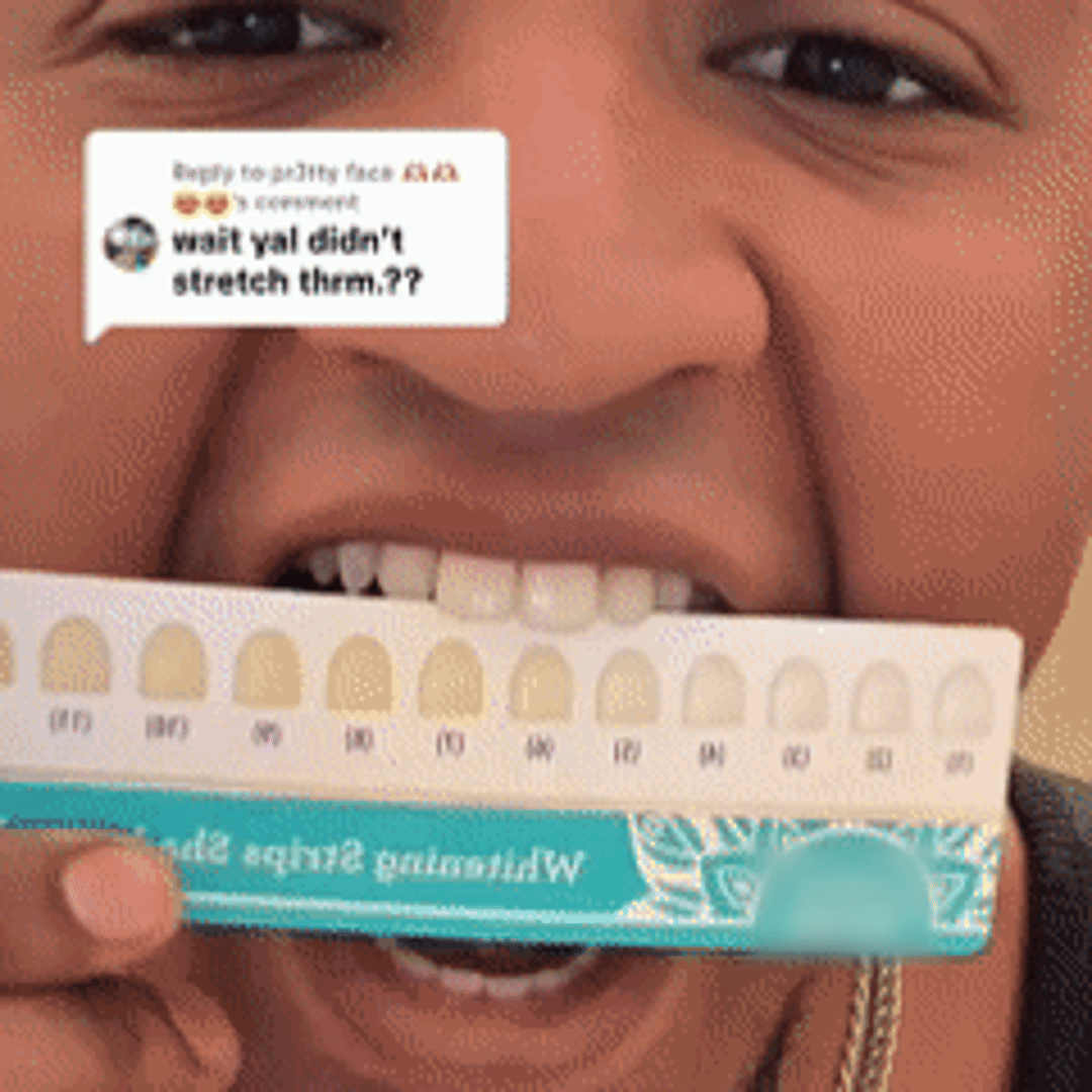 🥇 LBMLBM™ 7-Day Teeth Whitening Strips | Non-Slip Dry Strip Technology - Gentle, Fast Whitening for a Brighter, Confident Smile