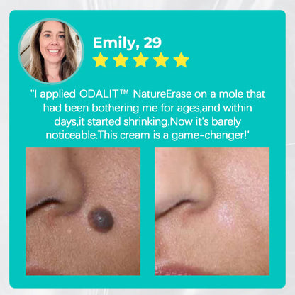 🥇Official Store: ODALIT™ Nature Erase Instant Mole & Spot Removal Gel | 🌿 Alligator Oil + Seaweed Extract🔥