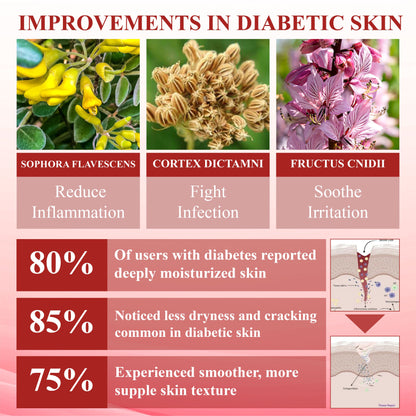 ODALIT™ GlucoseGuard Skin Rescue Cream – Hydrating & Healing Care for Diabetic Skin | 50% OFF Today