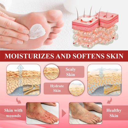 ODALIT™ GlucoseGuard Skin Rescue Cream – Hydrating & Healing Care for Diabetic Skin | 50% OFF Today