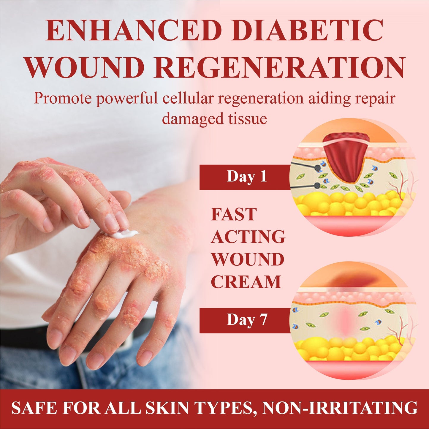 ODALIT™ GlucoseGuard Skin Rescue Cream – Hydrating & Healing Care for Diabetic Skin | 50% OFF Today