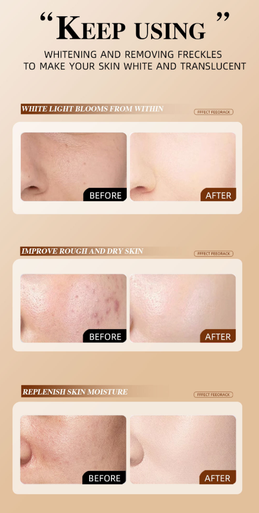 🔥LBMLBM™ Herbal Spots Peel-Off Facial Mask | Blackhead & Blemish Removal, Anti-Aging & Pore Tightening|🔥Limited Time 50% OFF!