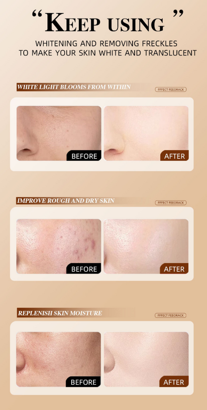 🔥LBMLBM™ Herbal Spots Peel-Off Facial Mask | Blackhead & Blemish Removal, Anti-Aging & Pore Tightening|🔥Limited Time 50% OFF!